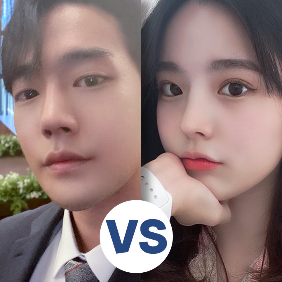 남자비염코성형 자세하게 알아보고 결정 관련 이미지 10