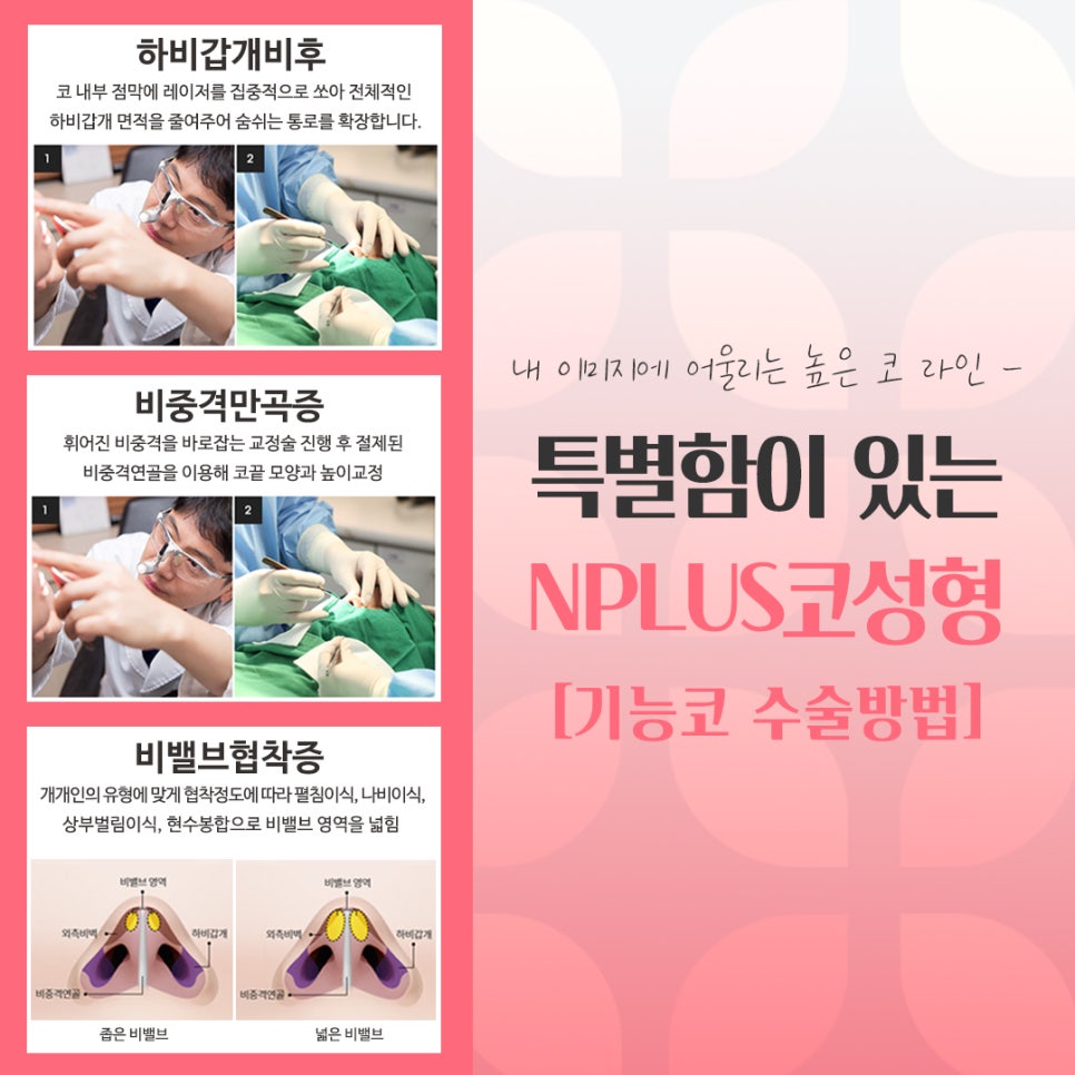 If You’re Looking for Detailed Reviews of Female Rhinoplasty image 11