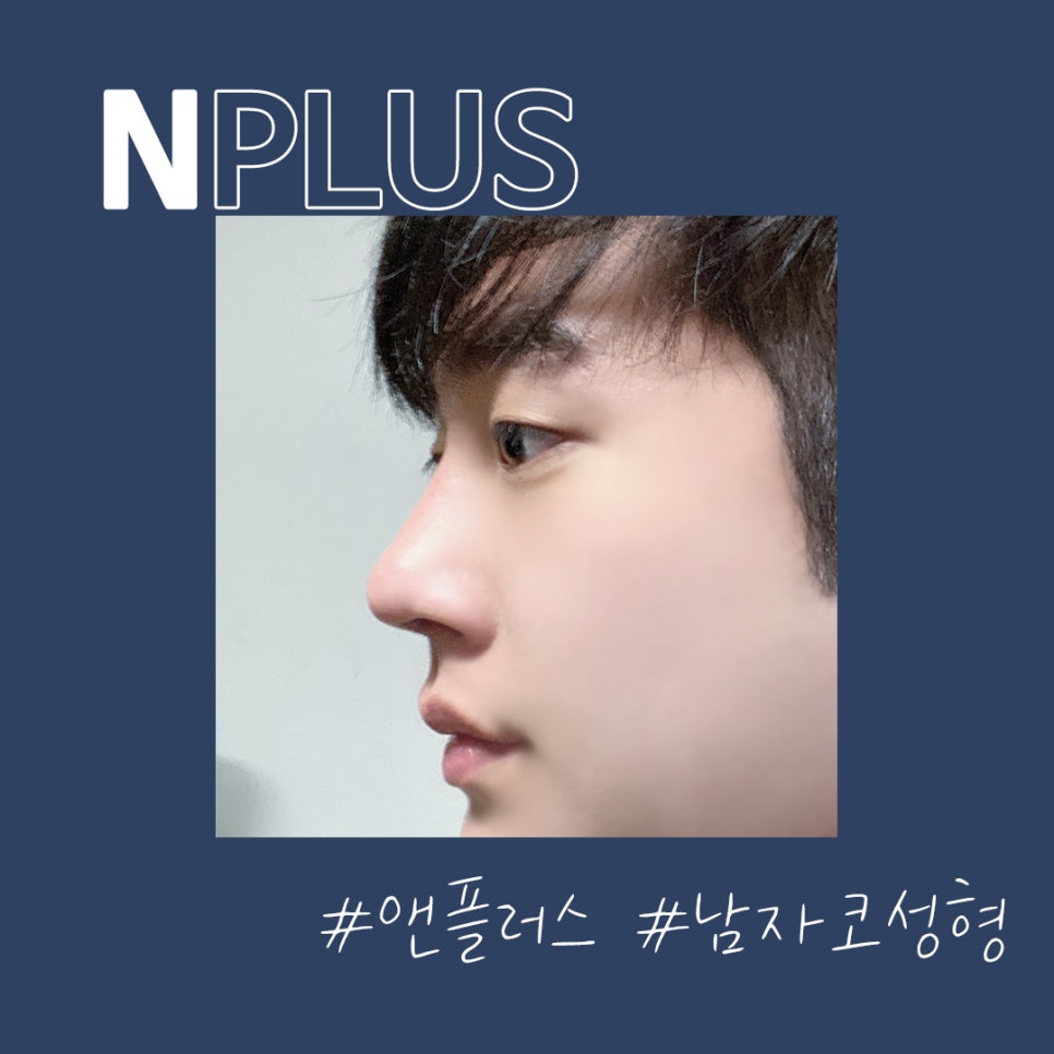 Male Rhinoplasty Review: Taking Functional Aspects into Consideration image 2