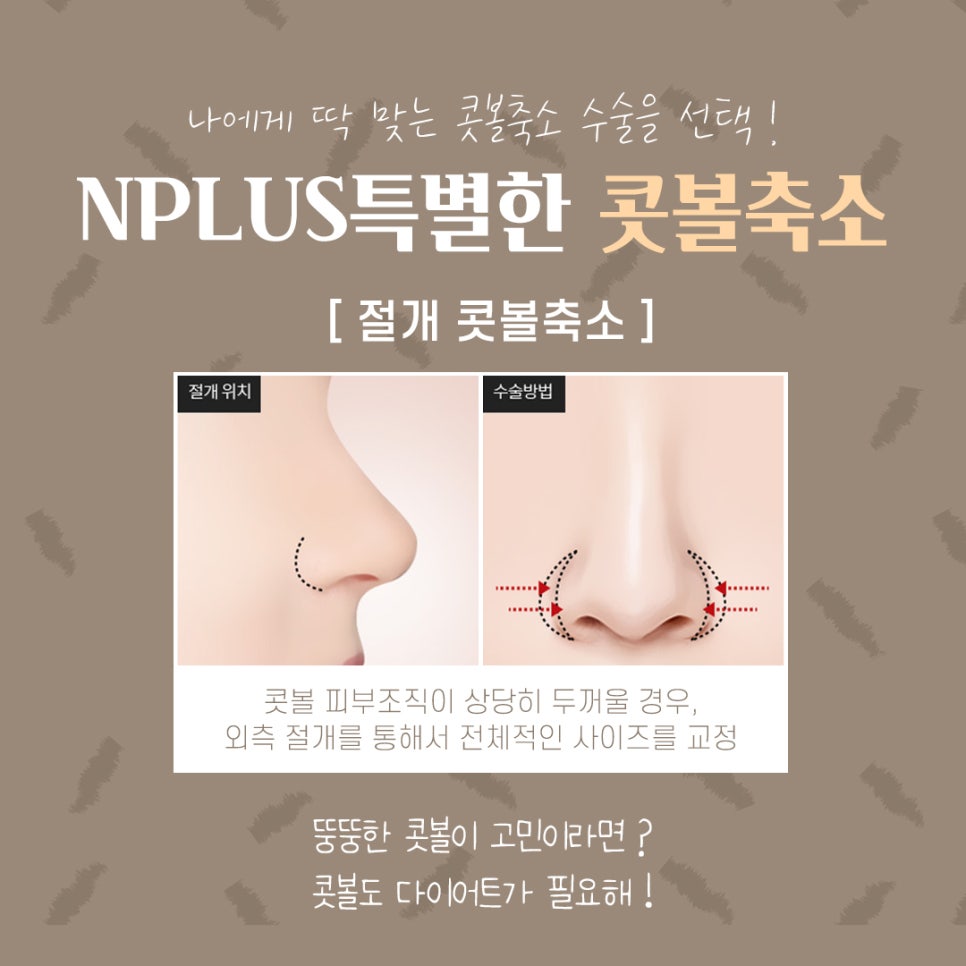 콧볼축소후기 퍼진코에 변화를 관련 이미지 8