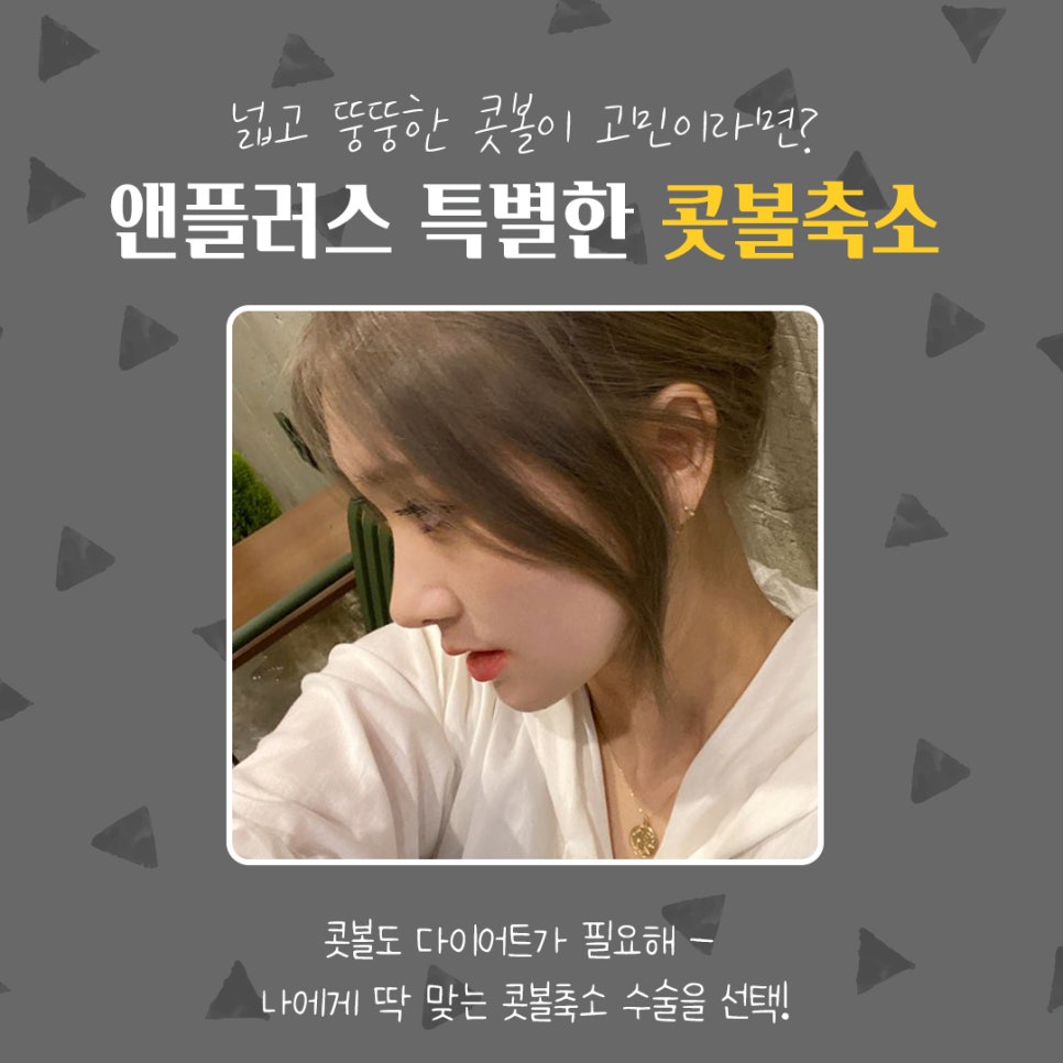 콧볼축소후기_넓은콧볼 고민해결 관련 이미지 2