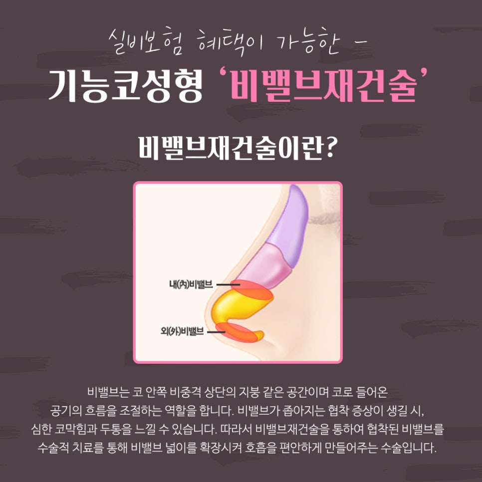비밸브재건술 확실한 강남앤플러스에서 관련 이미지 4