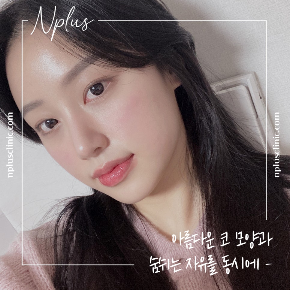 콧볼축소후기 원인을 정확하게 알아보고 관련 이미지 2