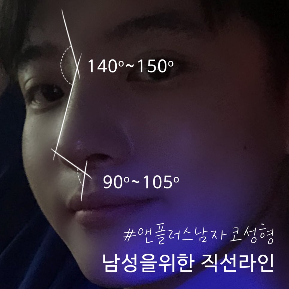 남자매부리코성형 기능까지 고려해서 관련 이미지 10