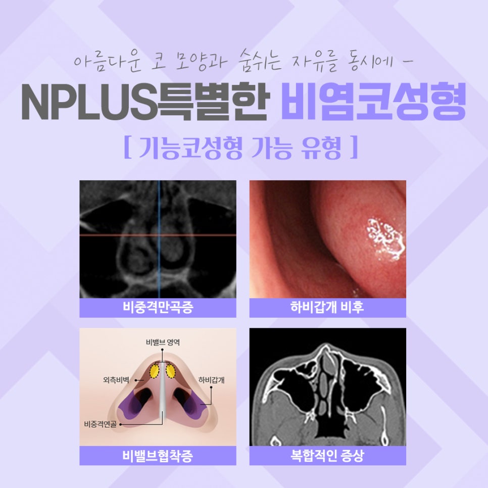 Check Exactly Rhinoplasty and Rhinitis Surgery Reviews image 3