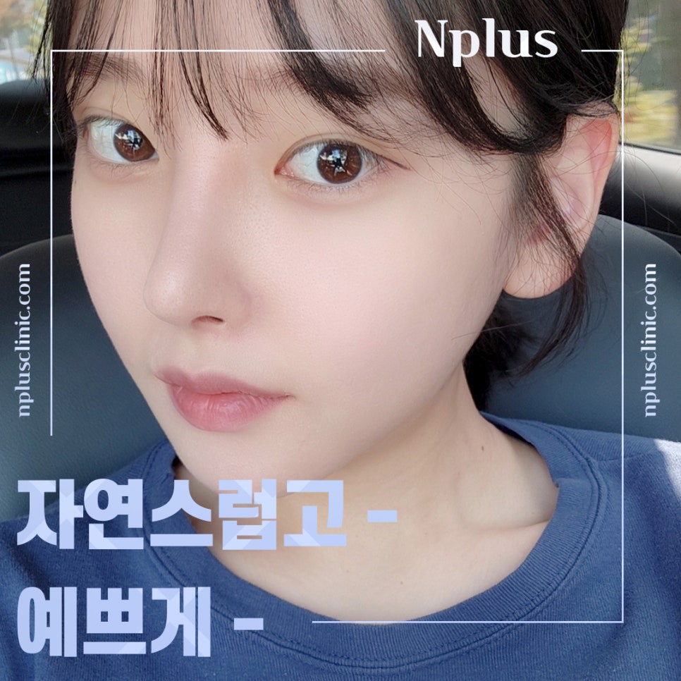 기능코성형 후기 보고 비교하여 관련 이미지 6