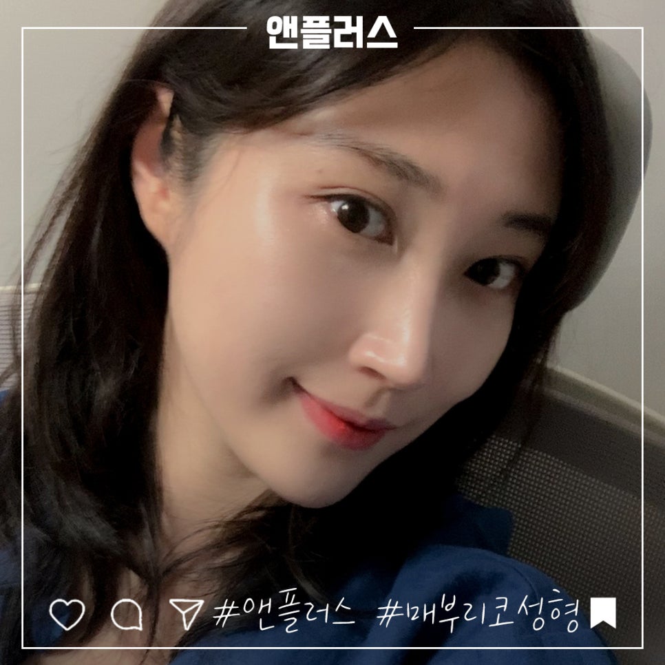 매부리코성형후기 꼼꼼하게 알아보고 관련 이미지 1