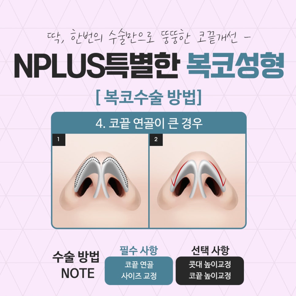 Be Sure to Learn About Bulbous Nose Surgery Reviews image 12