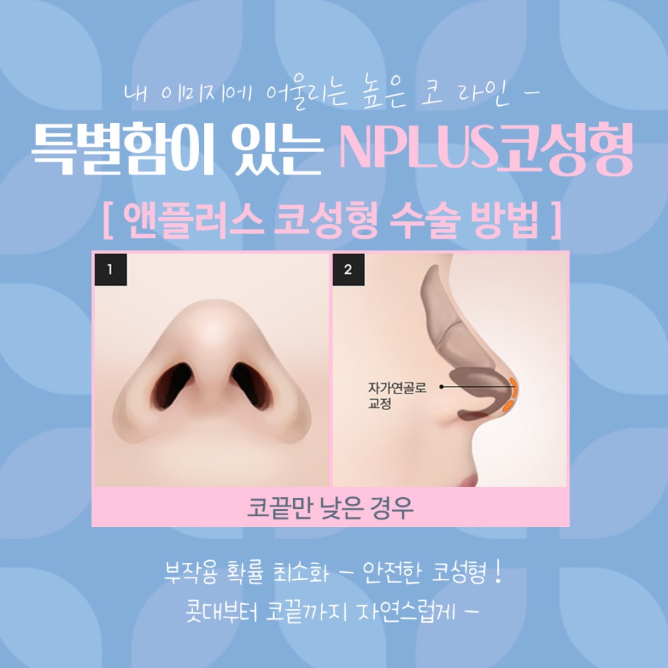 여자코수술후기 코 내부까지 확인하고 관련 이미지 11
