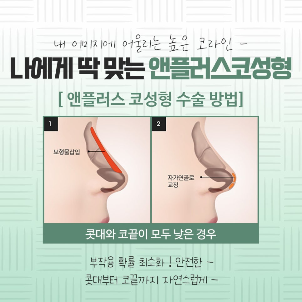 Check the Difference in Autologous Rib Nose Surgery Results image 8
