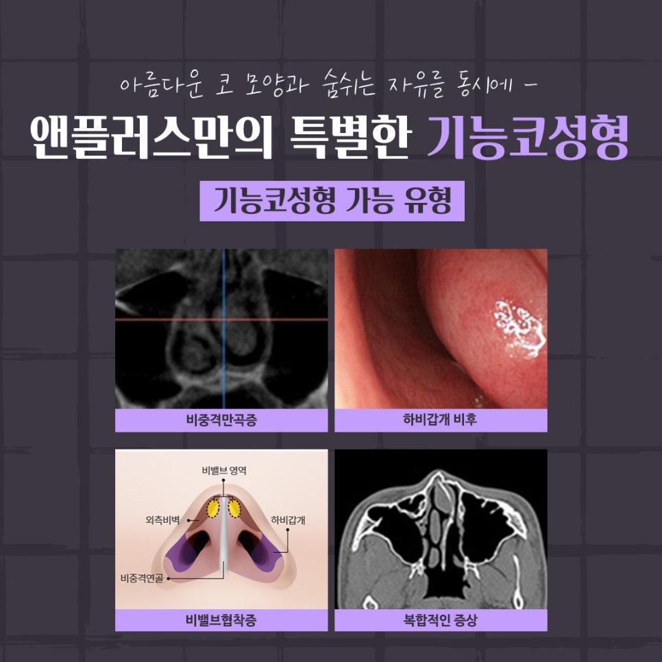 코성형후기 만족스러운 결과 관련 이미지 6