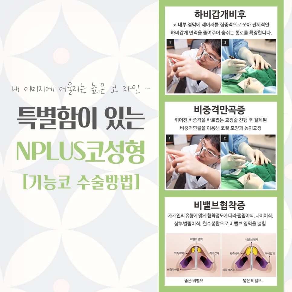 코수술잘하는곳에서 예쁘고 자연스럽게 관련 이미지 10
