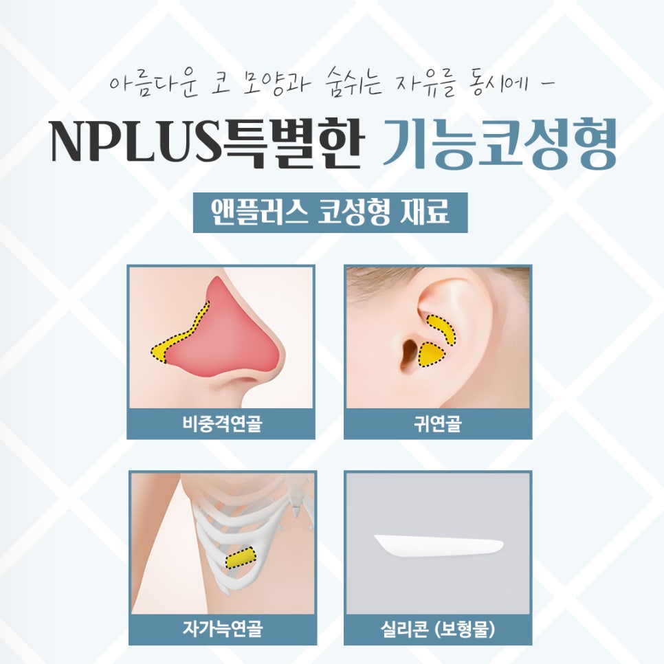 기능코성형후기를 통해 개선된 점 관련 이미지 11