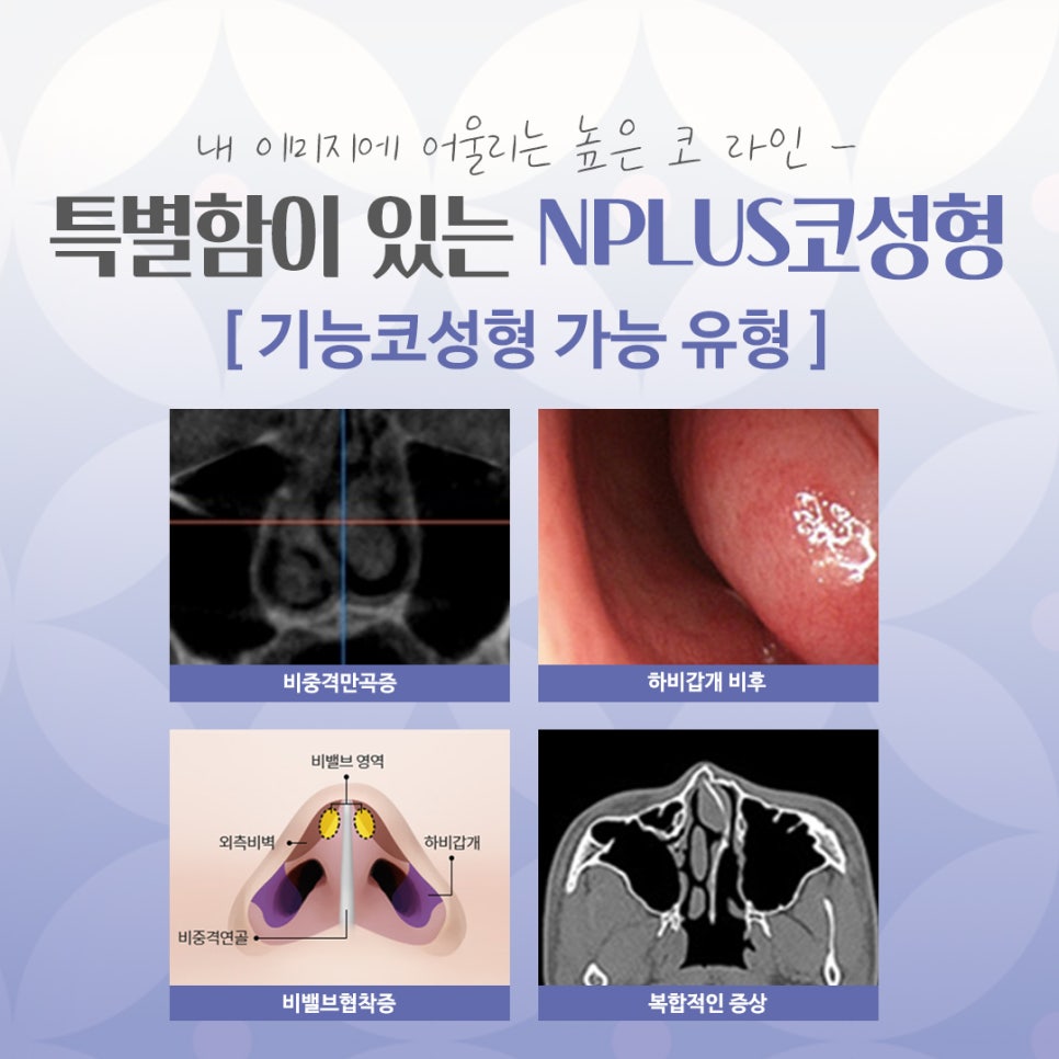 코수술잘하는곳에 대해 꼼꼼하게 체크하여 관련 이미지 5
