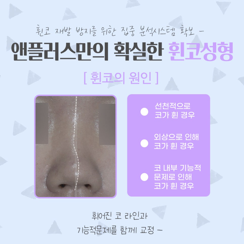 Taking a Thorough Look at Functional Deviated Nose Surgery image 3