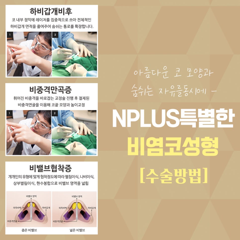 You Should Check the Rhinoplasty and Rhinitis Surgery Reviews Carefully Before Proceeding image 9