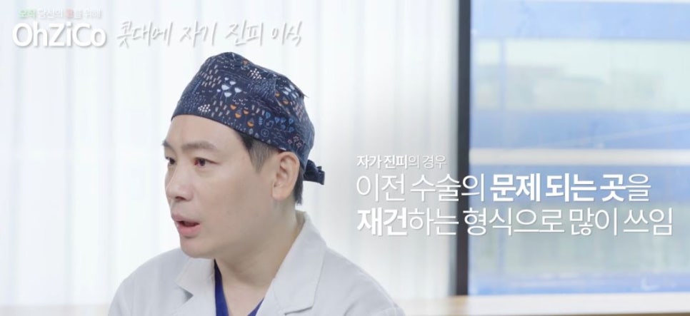 콧대성형에 사용되는 자가보형물 관련 이미지 5