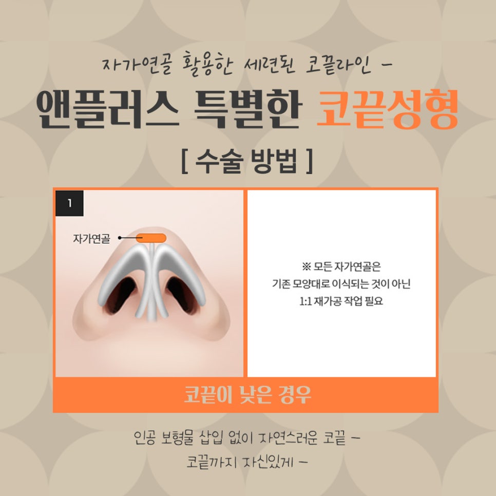 코끝수술후기 자가연골로 안전하게 관련 이미지 6