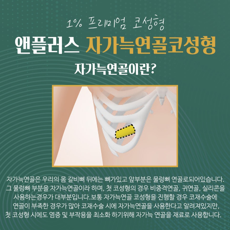 자가늑연골코수술로 처음부터 확실하게 관련 이미지 6