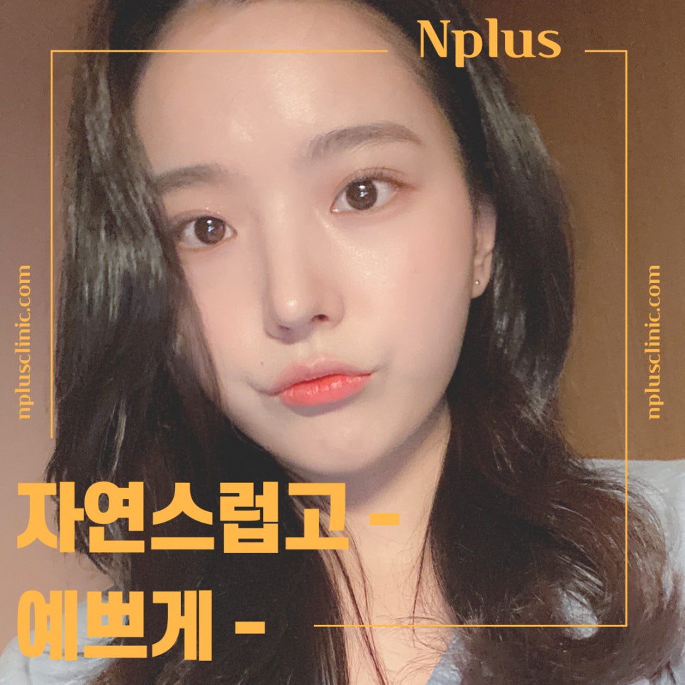 Autologous Cartilage Rhinoplasty for a Natural Nose Line image 13
