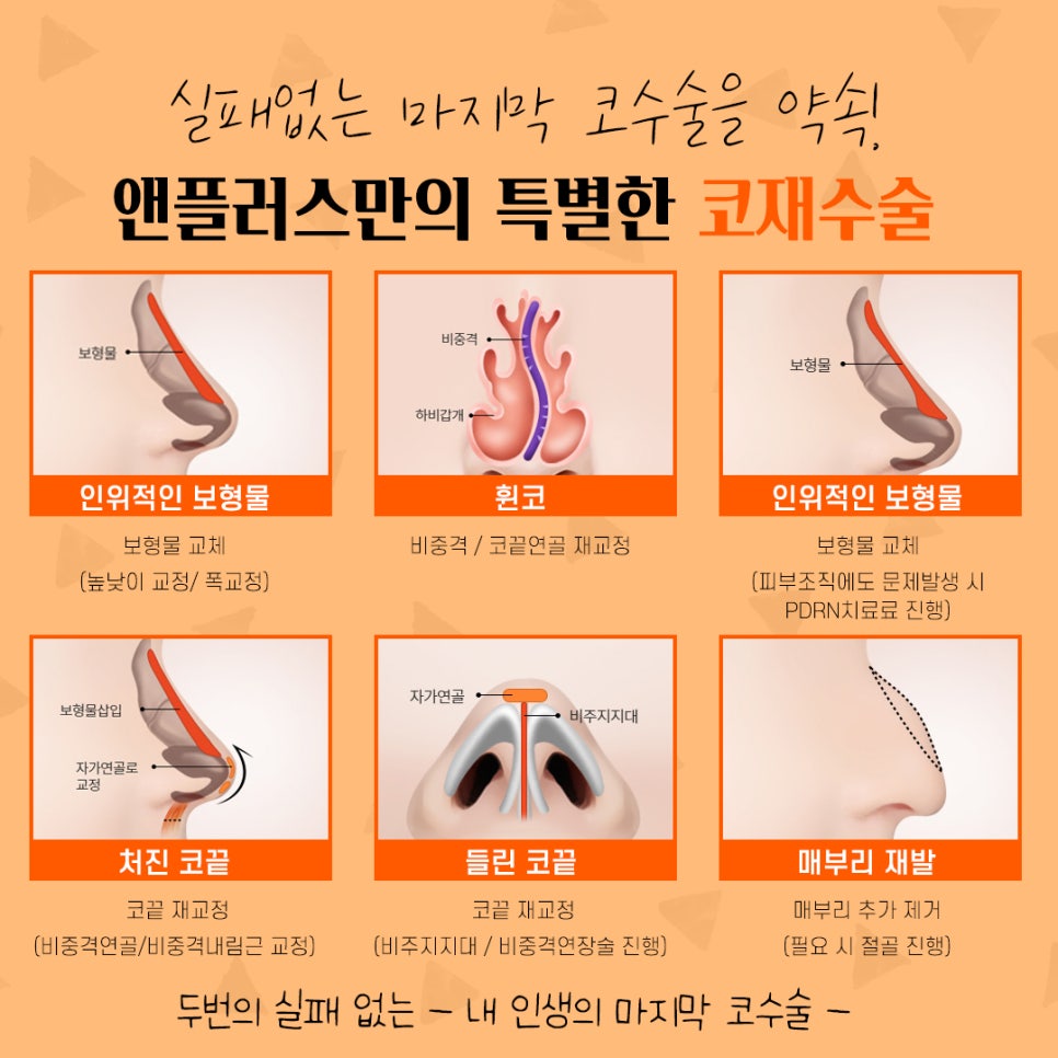코재수술후기 자연스럽고 예쁘게 관련 이미지 3