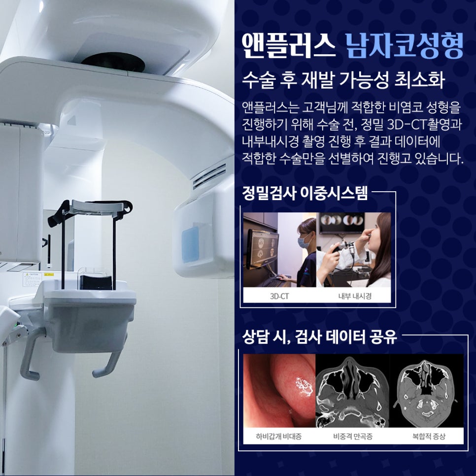남자코성형전후 남자다운 직선라인으로 관련 이미지 7