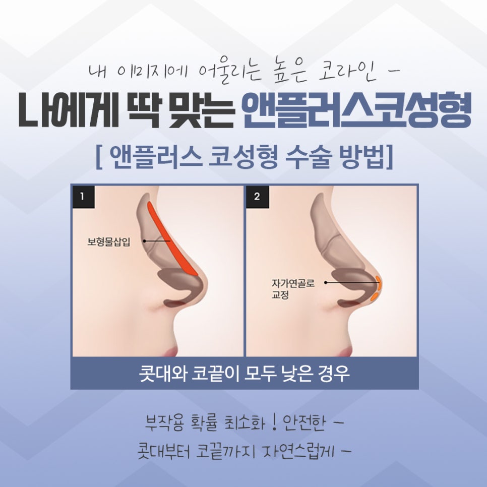 압구정코성형에서 자연스럽게 개선 관련 이미지 8