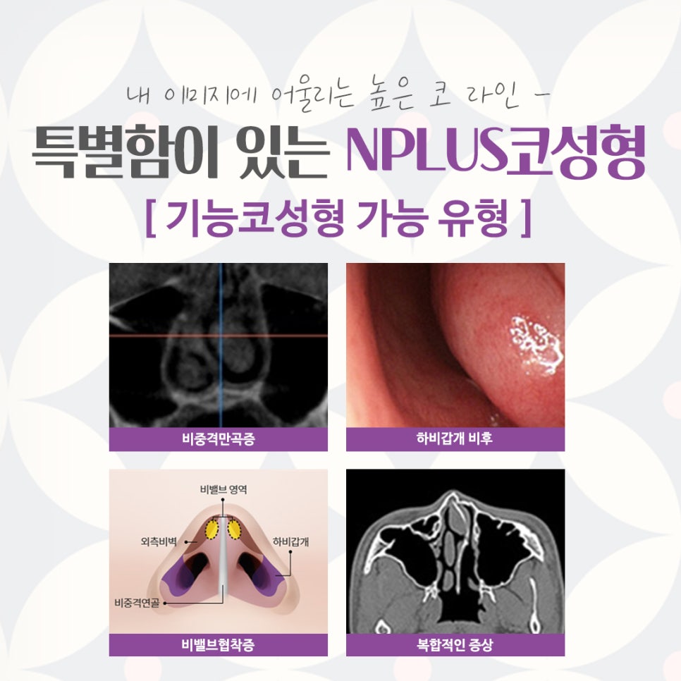 압구정성형외과에서 알려드리는 코수술후기 관련 이미지 5