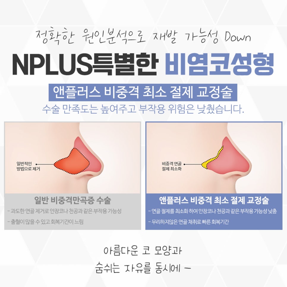 Nasal Surgery and Rhinoplasty: Identifying the Exact Cause image 11