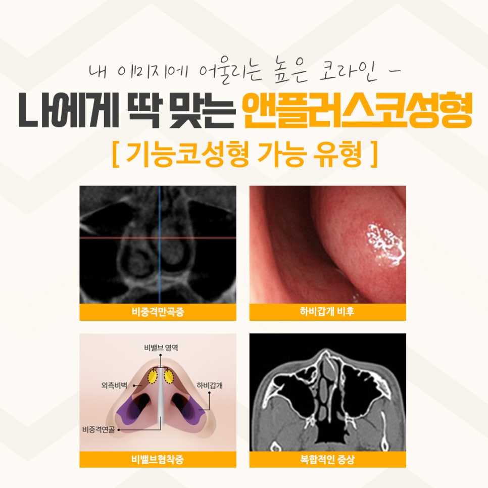 Understanding the Differences in Apgujeong Nose Surgery image 11