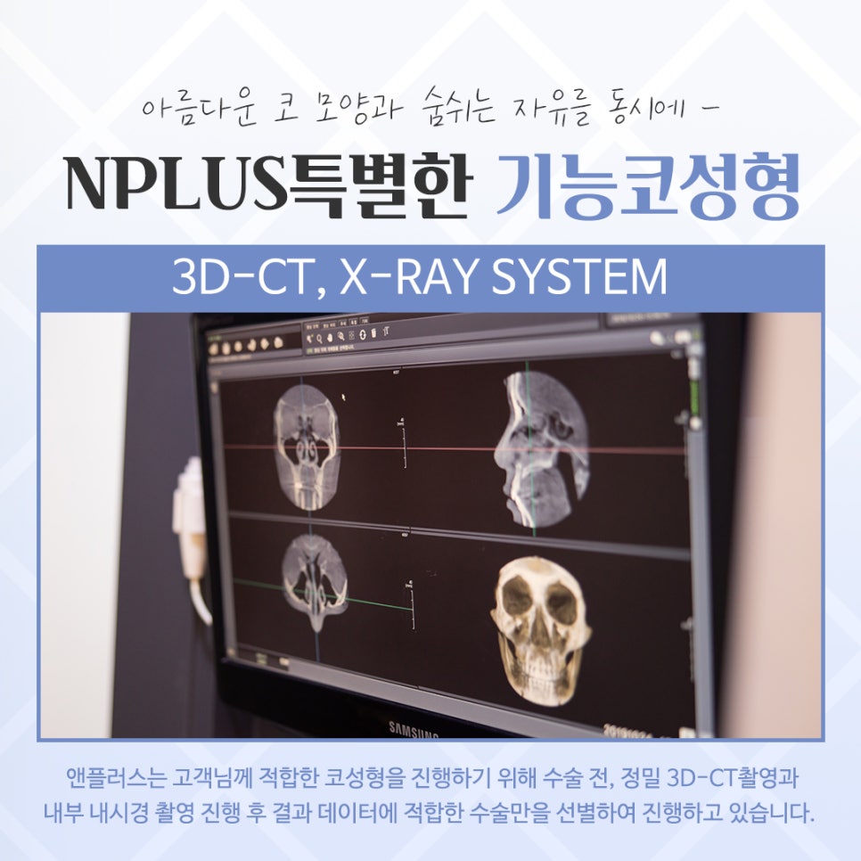 기능코성형 후기 보고 비교하여 관련 이미지 8