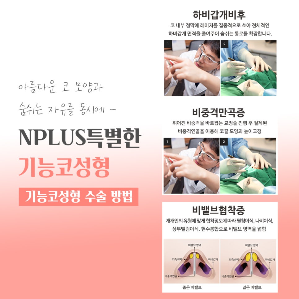 기능코성형후기 여러 가지를 비교하고 관련 이미지 9