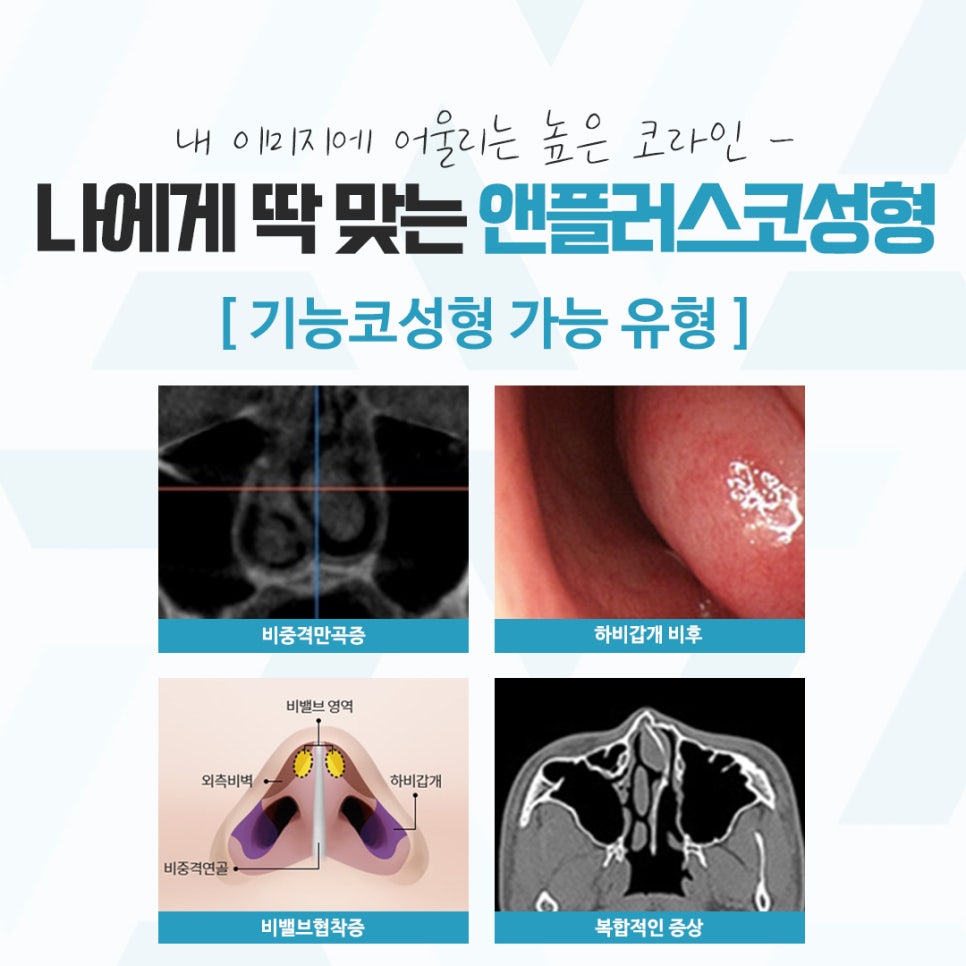 코성형후기 다양한 이미지를 고려하여 관련 이미지 6