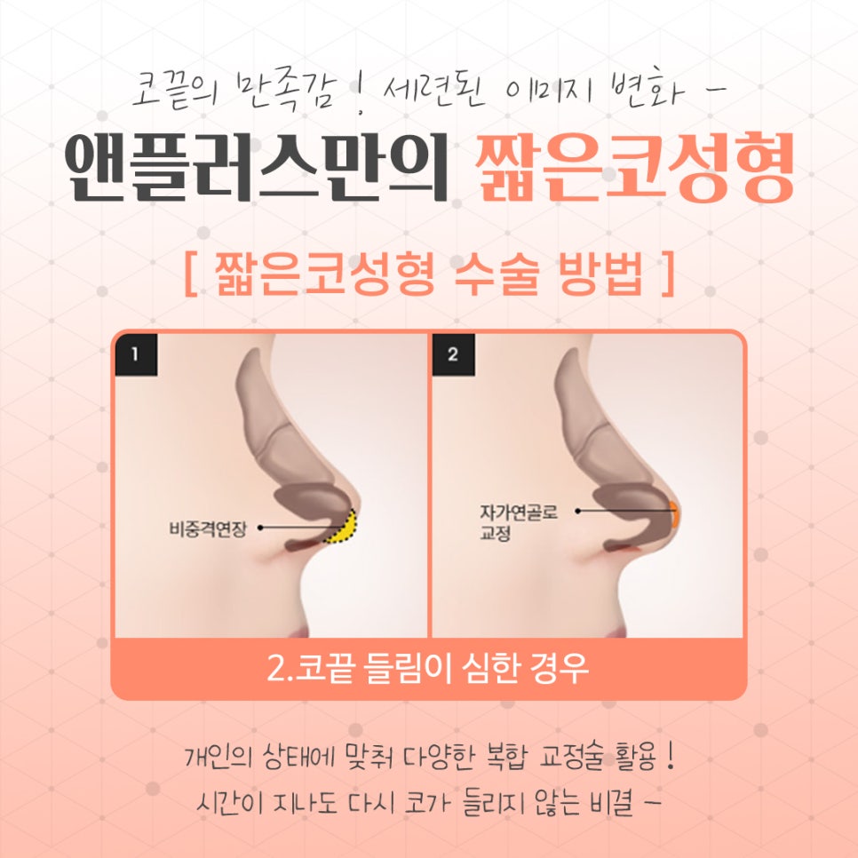 Naturally and Beautifully Through Short Nose Surgery image 10