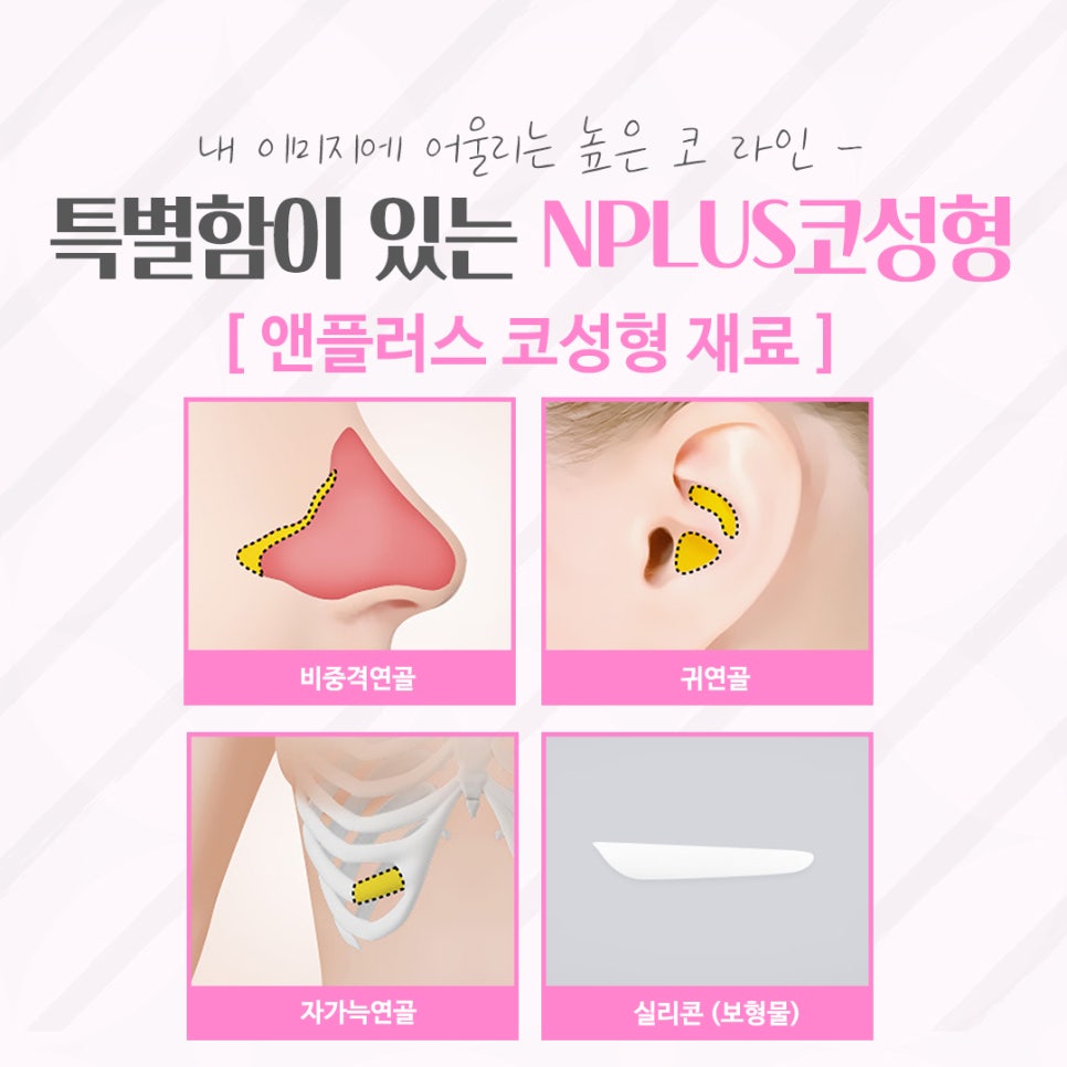 압구정코수술 자연스러운 라인으로 관련 이미지 8