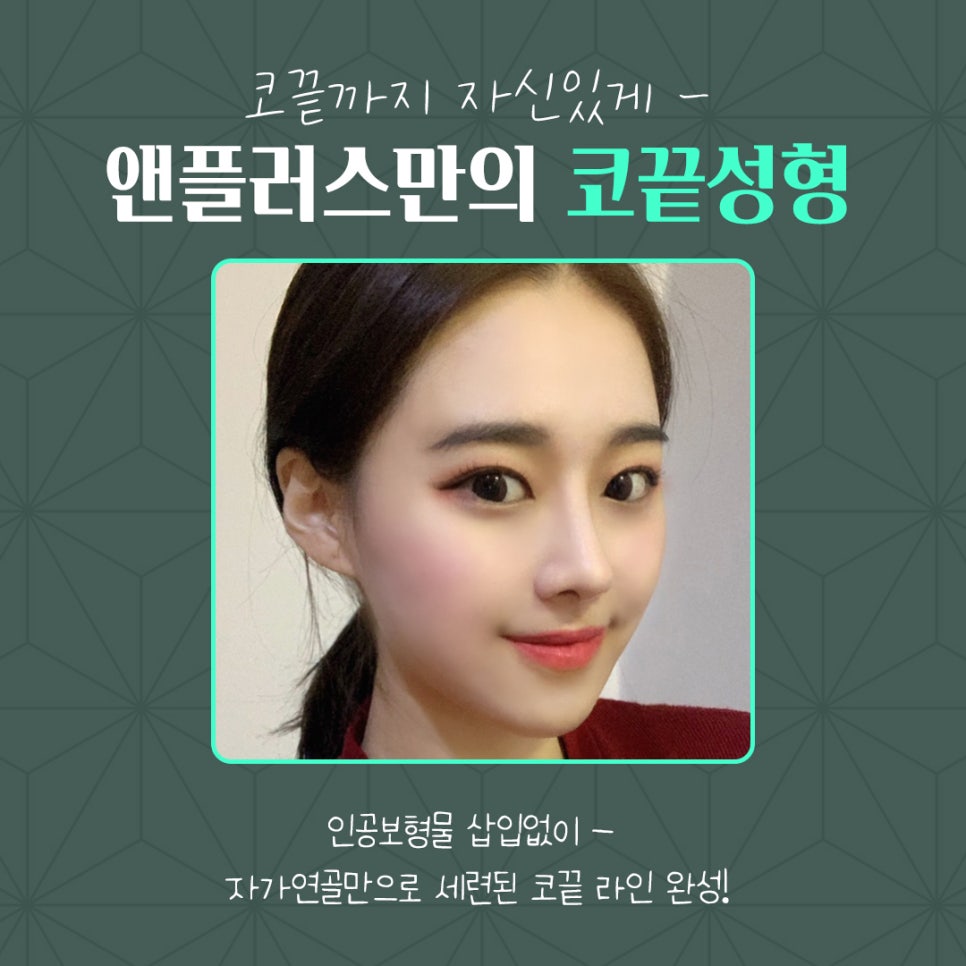 코끝연골묶기 활용한 코끝성형 관련 이미지 2