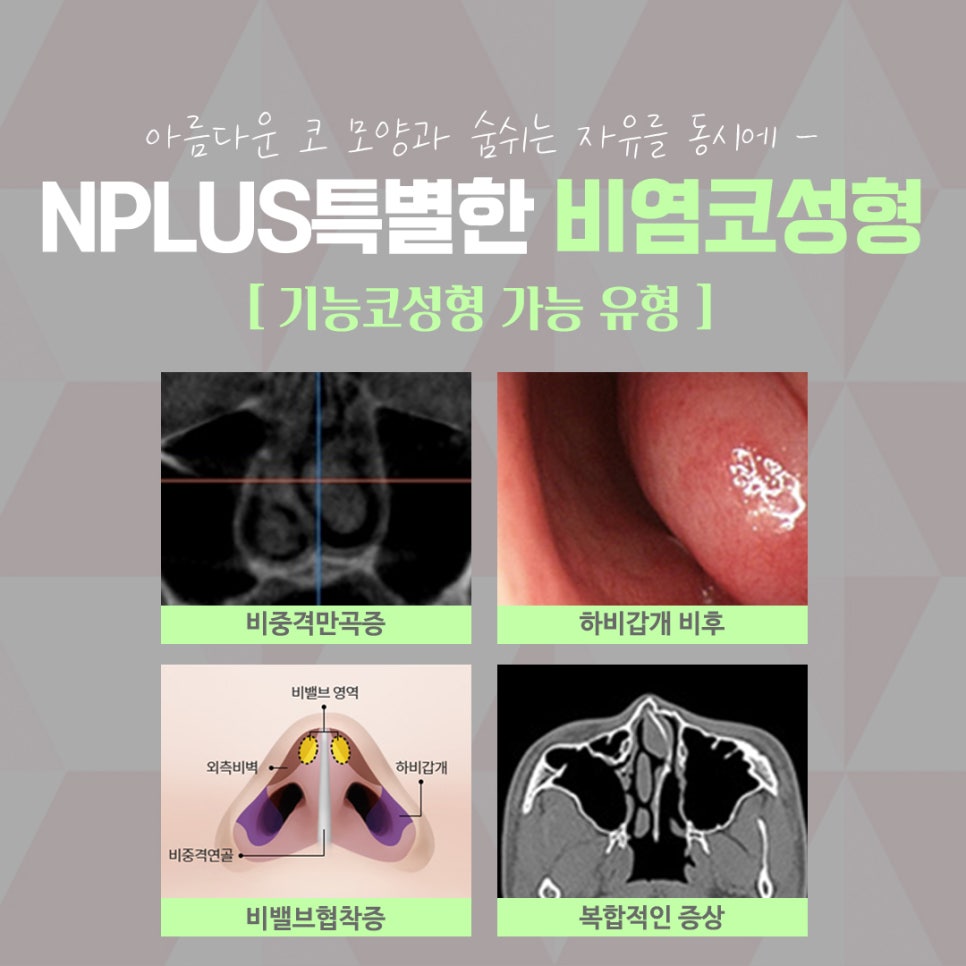 앤플러스에서 알려드리는 잠잘때코막힘 해결 관련 이미지 5