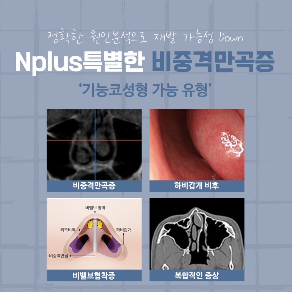 The Importance of Choosing a Septoplasty Review image 5