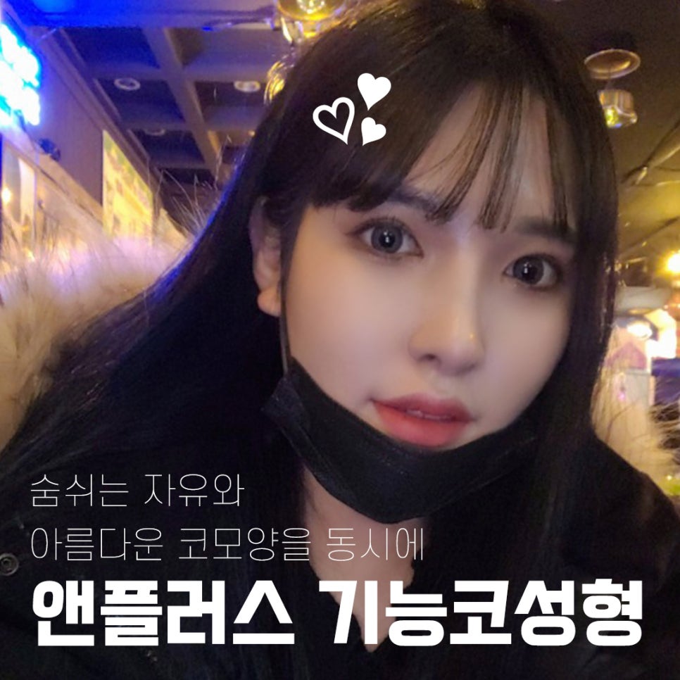 앤플러스에서 알려드리는 성형외과 기능코성형후기 관련 이미지 1