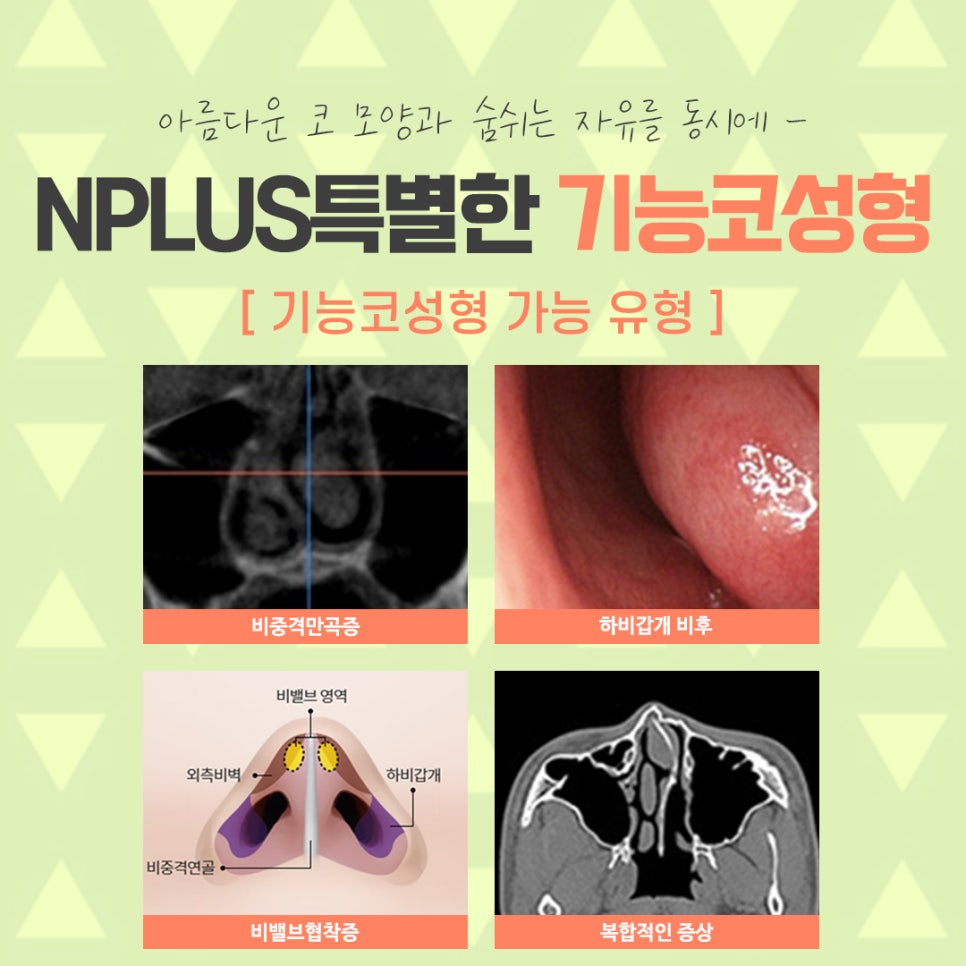 코성형보험에 대해 정확하게 알아보고 관련 이미지 5