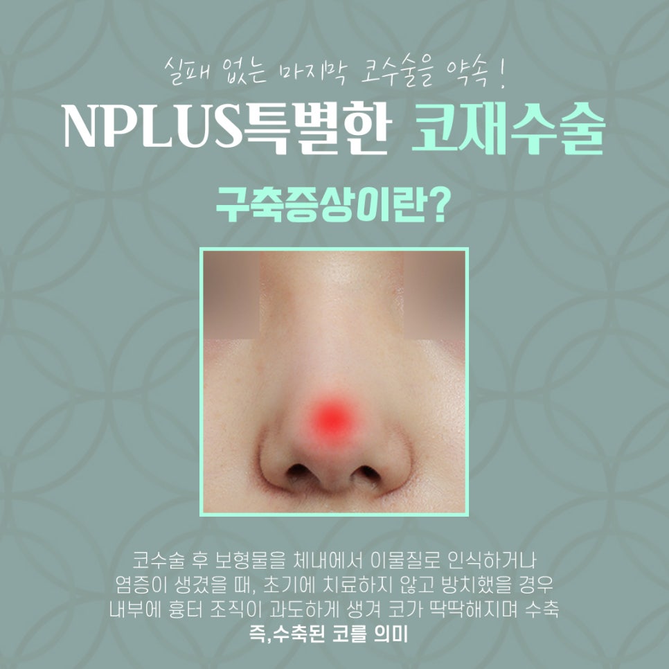 압구정성형외과에서 알아보는 코재수술후기 관련 이미지 6