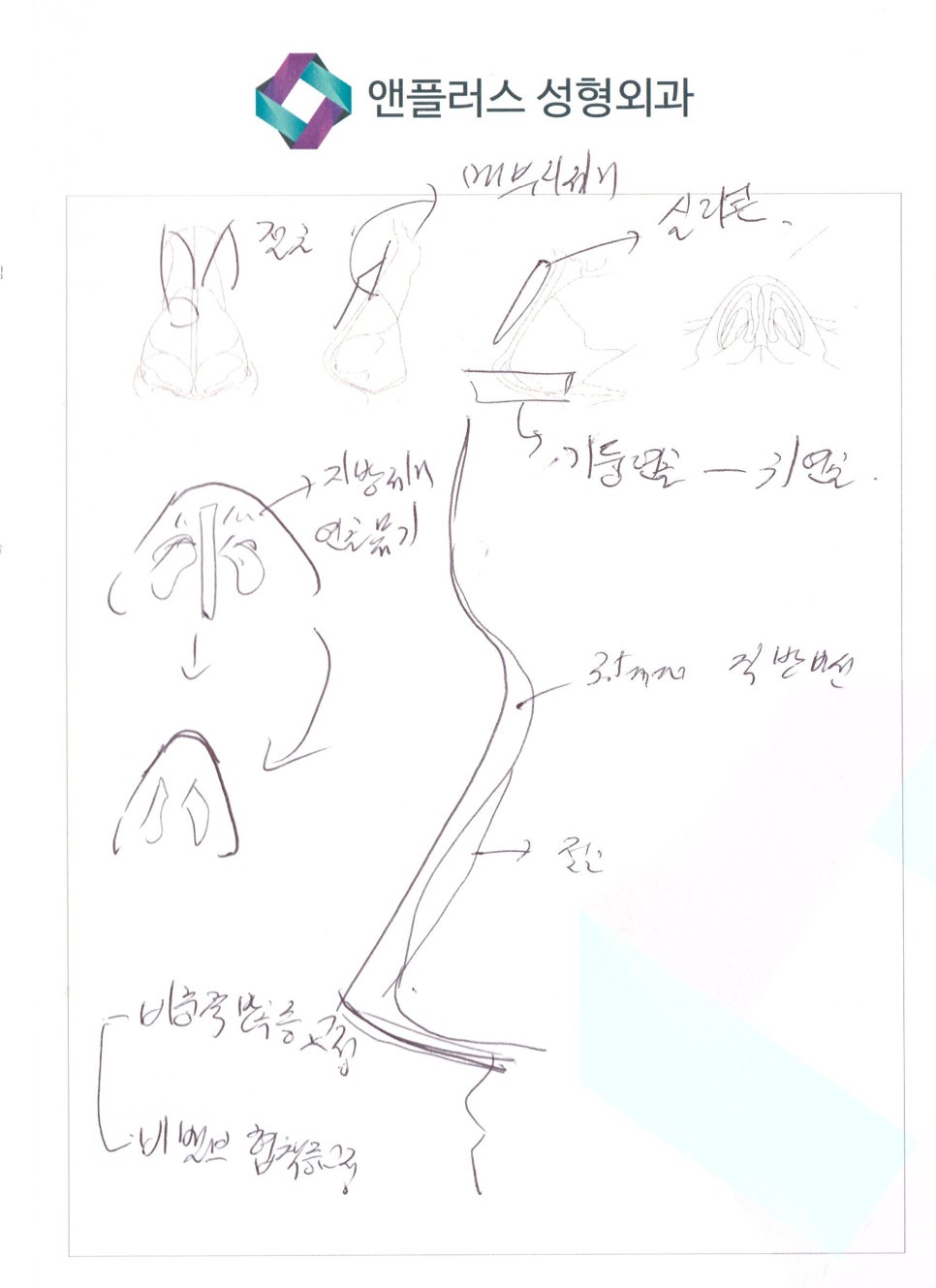 여자매부리코와 비염수술후기 관련 이미지 6
