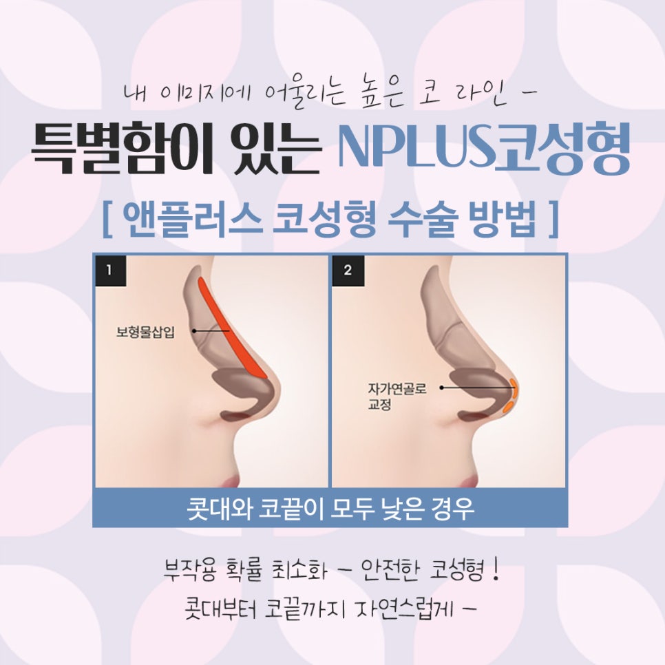 Nose Surgery Review: A Natural and Glamorous Line image 6