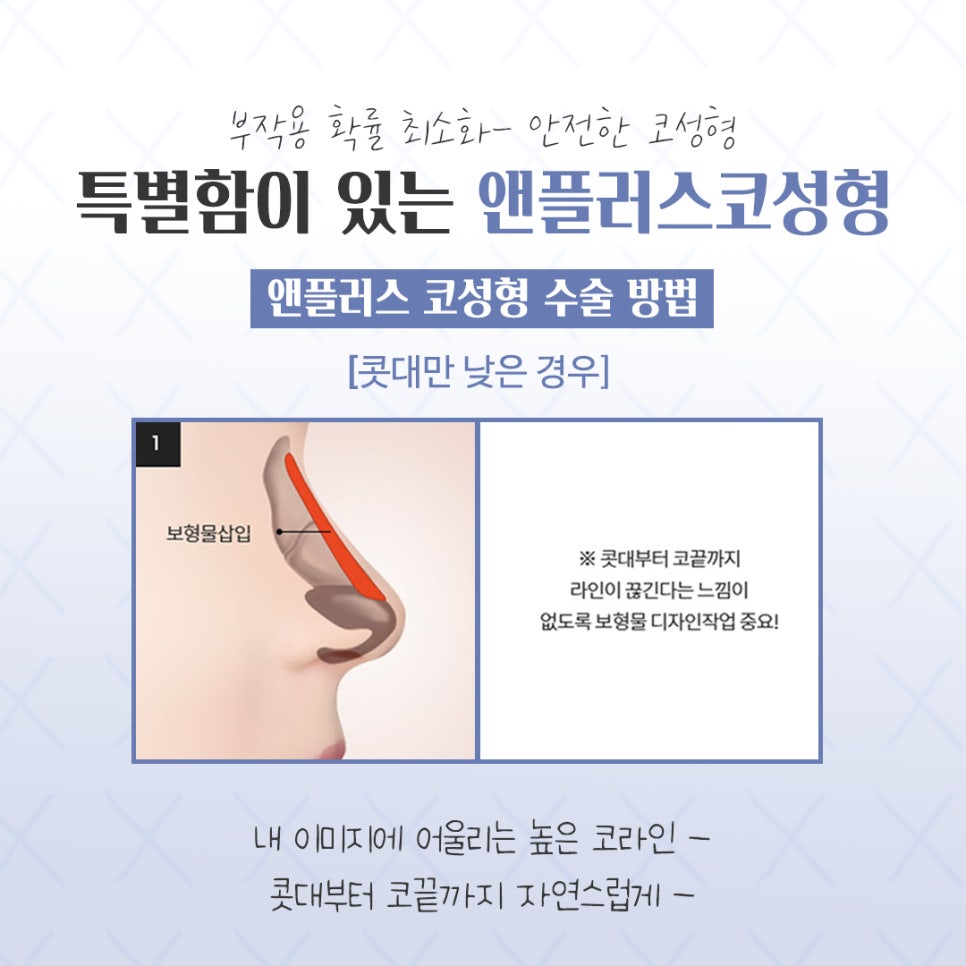 코성형전후 개선할 점을 확인하고 관련 이미지 9