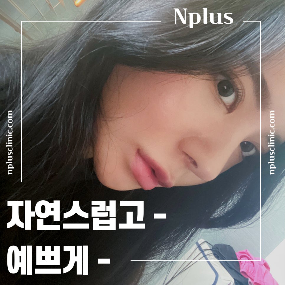 짧은코성형후기 자연스럽고 예쁘게 관련 이미지 4