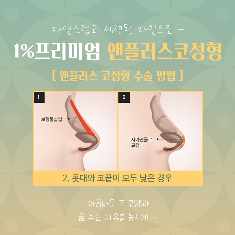 자가늑코성형 정확한 포인트를 파악하여 관련 이미지 8