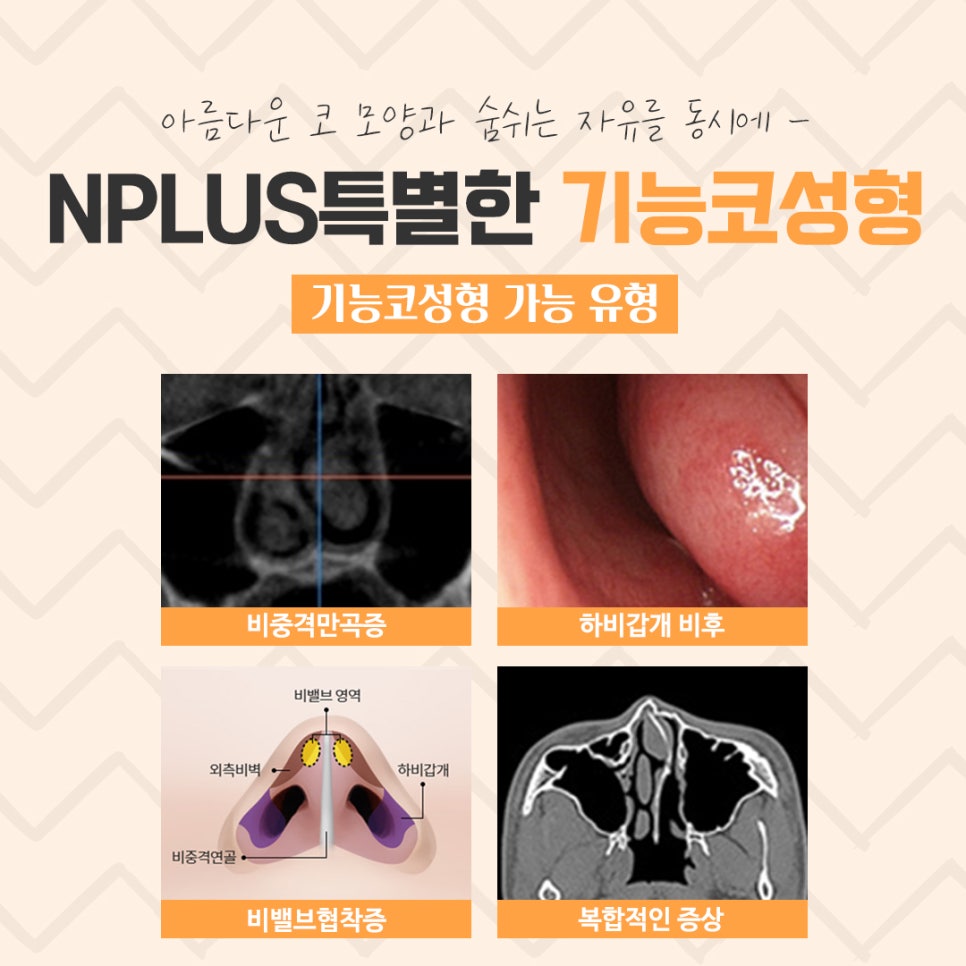 Making a Careful Decision After Researching an ENT Clinic for Rhinoplasty image 4