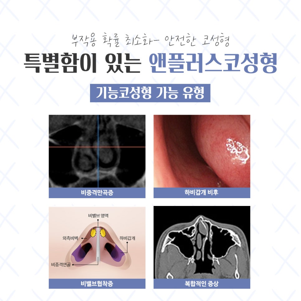 Looking Closely at the Differences Before and After Nose Surgery image 5