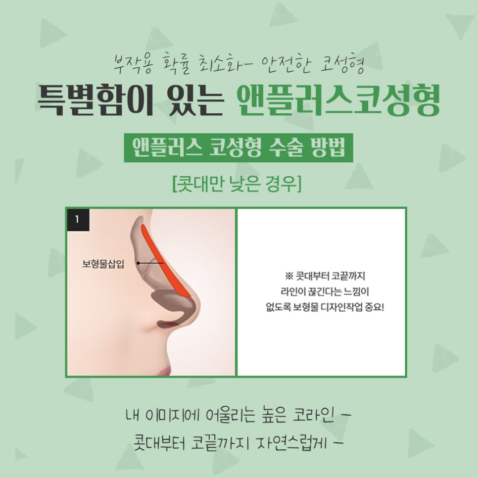 코성형후기 자연스럽고 예쁘게 관련 이미지 9