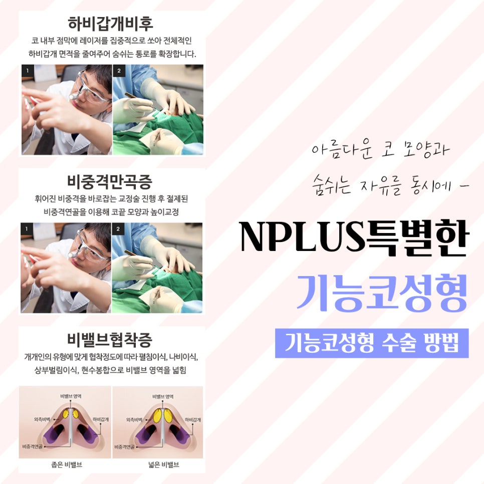 코수술후기에 대해 정확하게 진단하여 관련 이미지 7